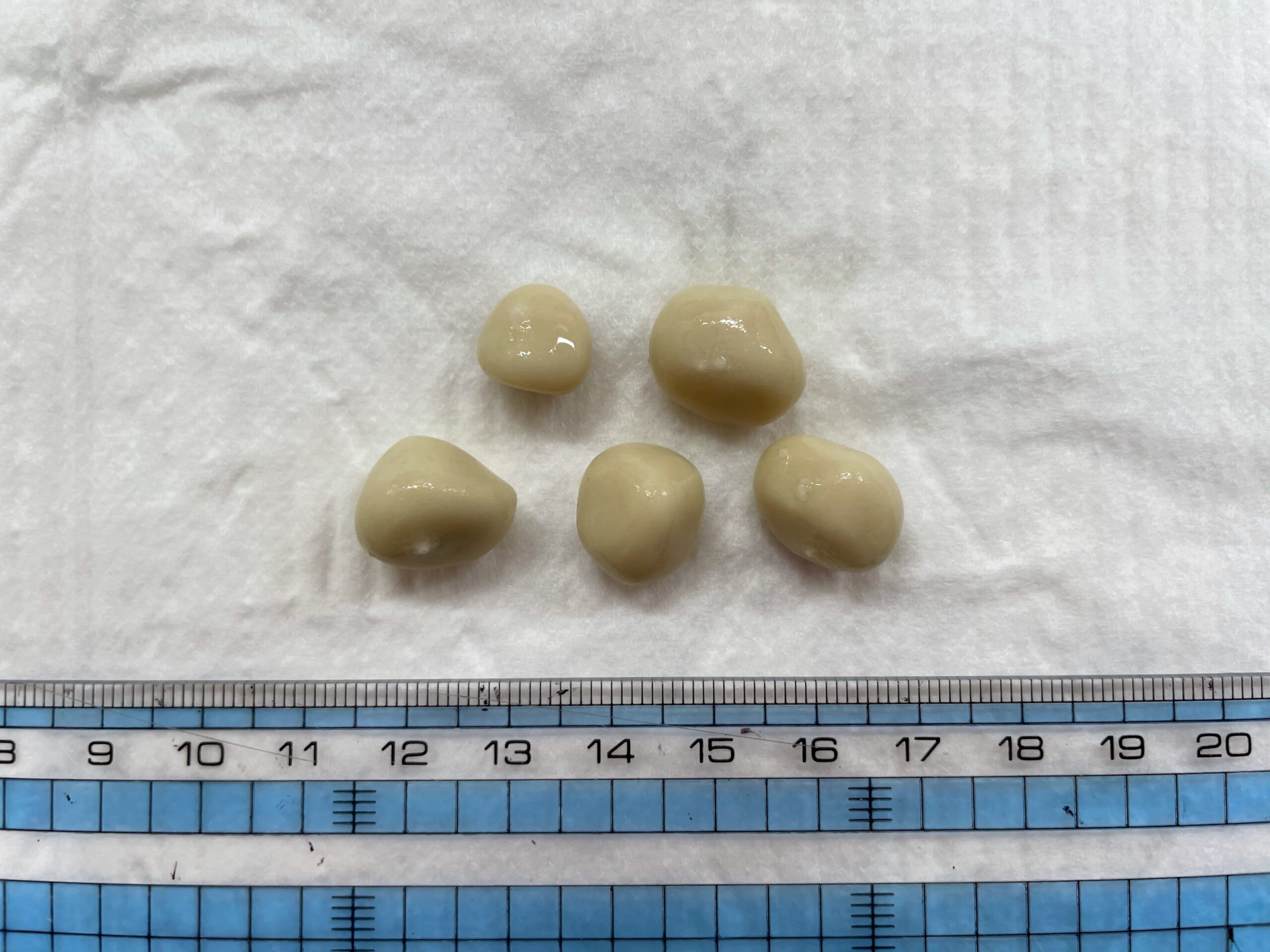 膀胱結石の原因